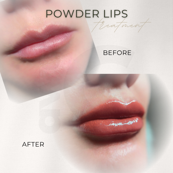Vorher-Nachher-Vergleich eines Lippenbehandlungsprozesses mit Powder-Lips.
