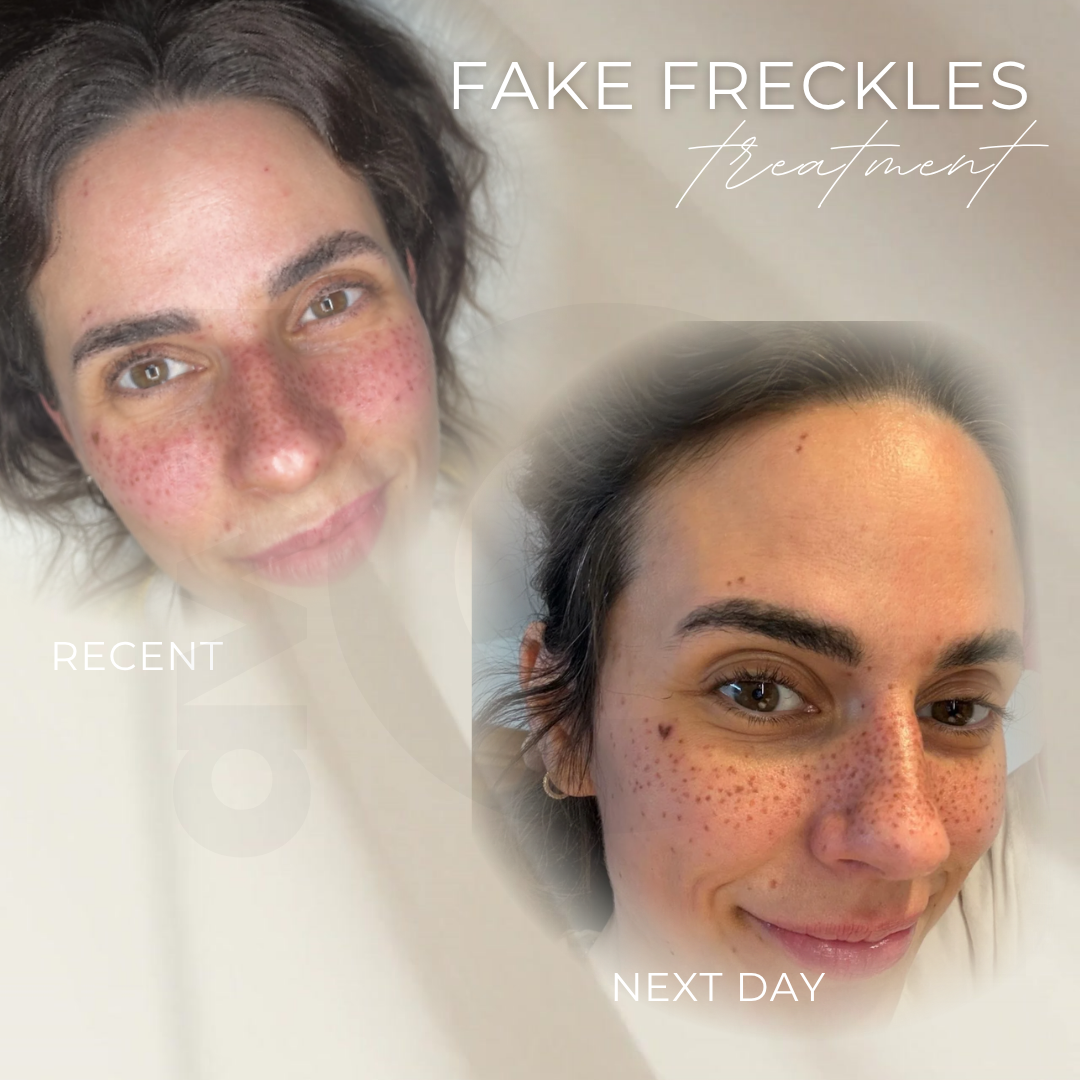 Fake Freckles in Grevenbroich